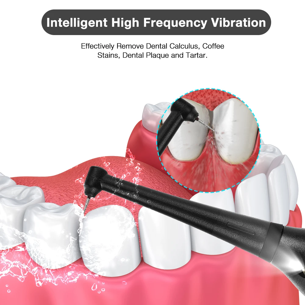 Electrice portabile Sonic Irigator Oral Detartraj Dentar Dinte Calcul Irigator Oral USB Reîncărcabilă Dentist Albire Dinti Oral