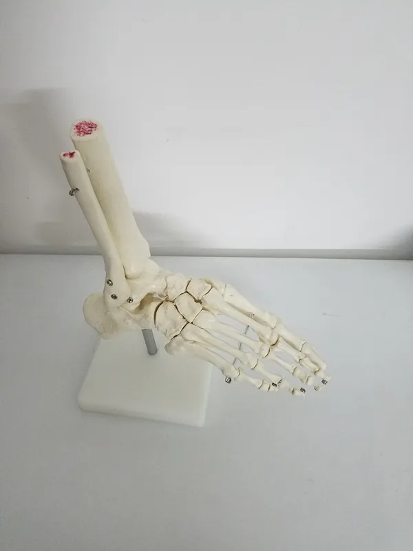 1:1 Dimensiunea De Viață Comun Picior Model De Om Schelet Modele Umane Os De La Picior Si Glezna Model De Viață Dimensiune Medicale Anatomice Ale Scheletului Model