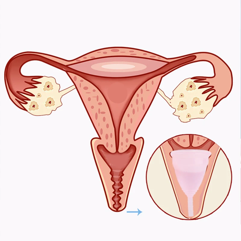 Silicon Medical Cupa Menstruala Sterilizator de igienă Feminină Cupa Menstruala Sterilizare Cupa Menstruala Pentru Femei ciclu Menstrual